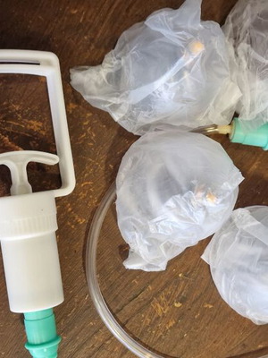 Cupping sets new
