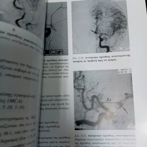 Clinical and Radiological Study used