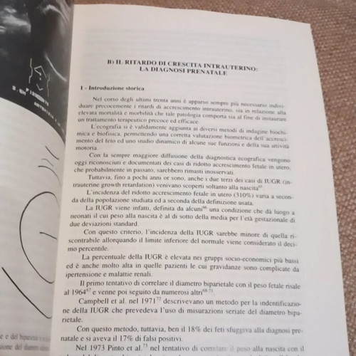 Il difetto di crescita intrauterino book used, Italian