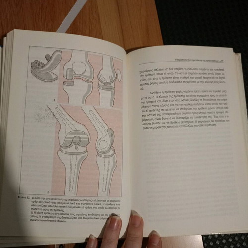 When the Knee Hurts book used, medical science