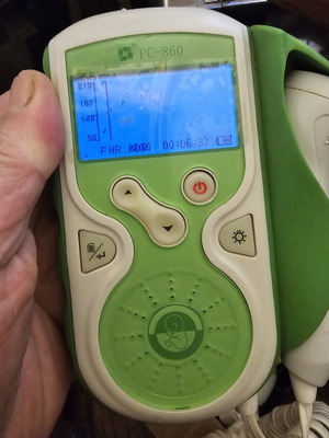 Baby Doppler ultrasound device used, gynecological