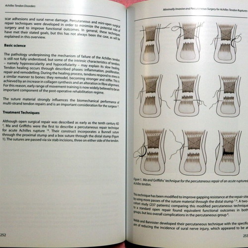 Achilles Tendon Disorders new, English medical textbook