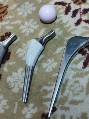 Total hip arthroplasty components, three metal femoral stems and ceramic head