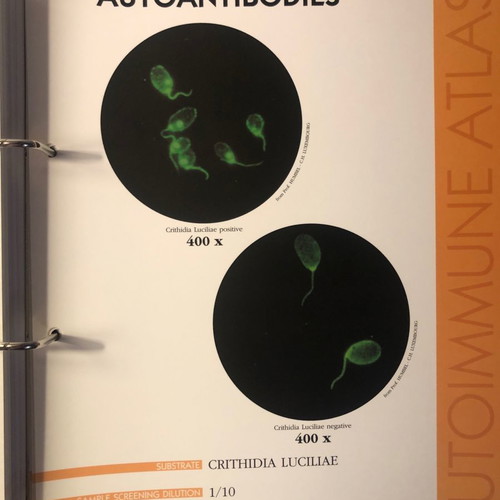 Autoimmune Diseases Atlas book used