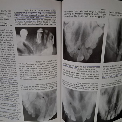 Endostomatiki Aktinografia book like new, Greek