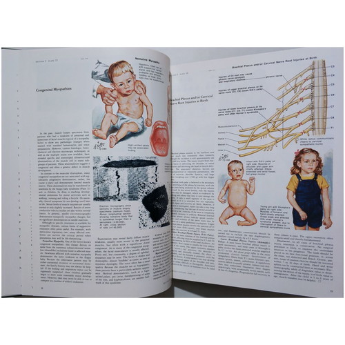 The Ciba Collection of Medical Illustrations like new, Nervous system, Netter