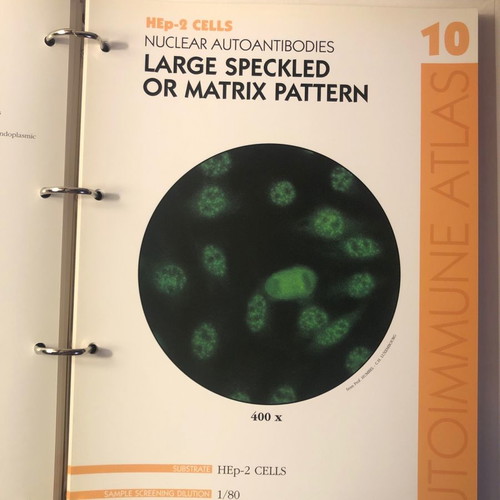 Autoimmune Diseases Atlas book used