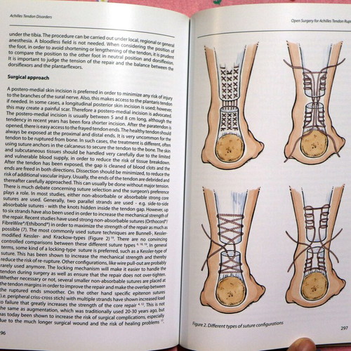 Achilles Tendon Disorders new, English medical textbook