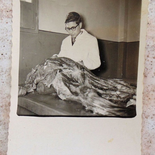 Rare Small-Sized Medical School Autopsy Photo 1961 used