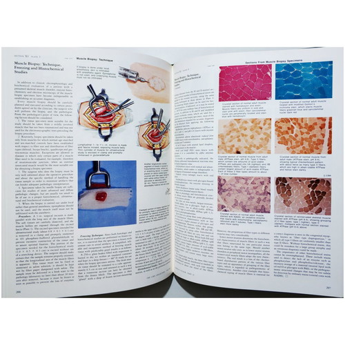 The Ciba Collection of Medical Illustrations like new, Nervous system, Netter