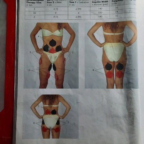 Lymphomed lymphatic massage and myotonia device used