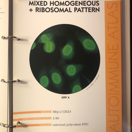 Autoimmune Diseases Atlas book used