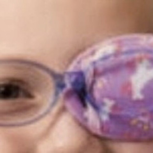 Kay Fun Patch medical eye patch like new for amblyopia treatment