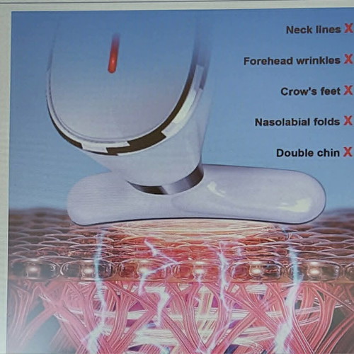 Electric face and neck massager new, with 7-color vibration and thermal mode