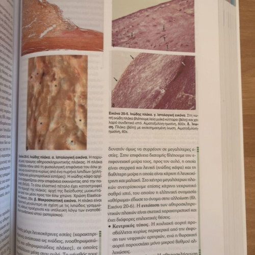 Pathological Anatomy Bocker Volume 1 new condition, includes volumes 1-2