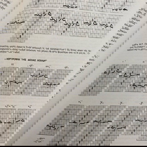 Κλινικό Ηλεκτροκαρδιογράφημα Goldberger Λίτσας 1978